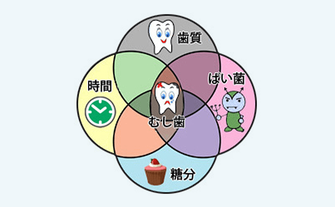 虫歯 船橋の歯科 歯医者 あおぞら歯科クリニック本院 土日祝日診療 駐車場完備 虫歯 船橋の歯科 歯医者 あおぞら歯科クリニック本院 土日祝日診療 駐車場完備