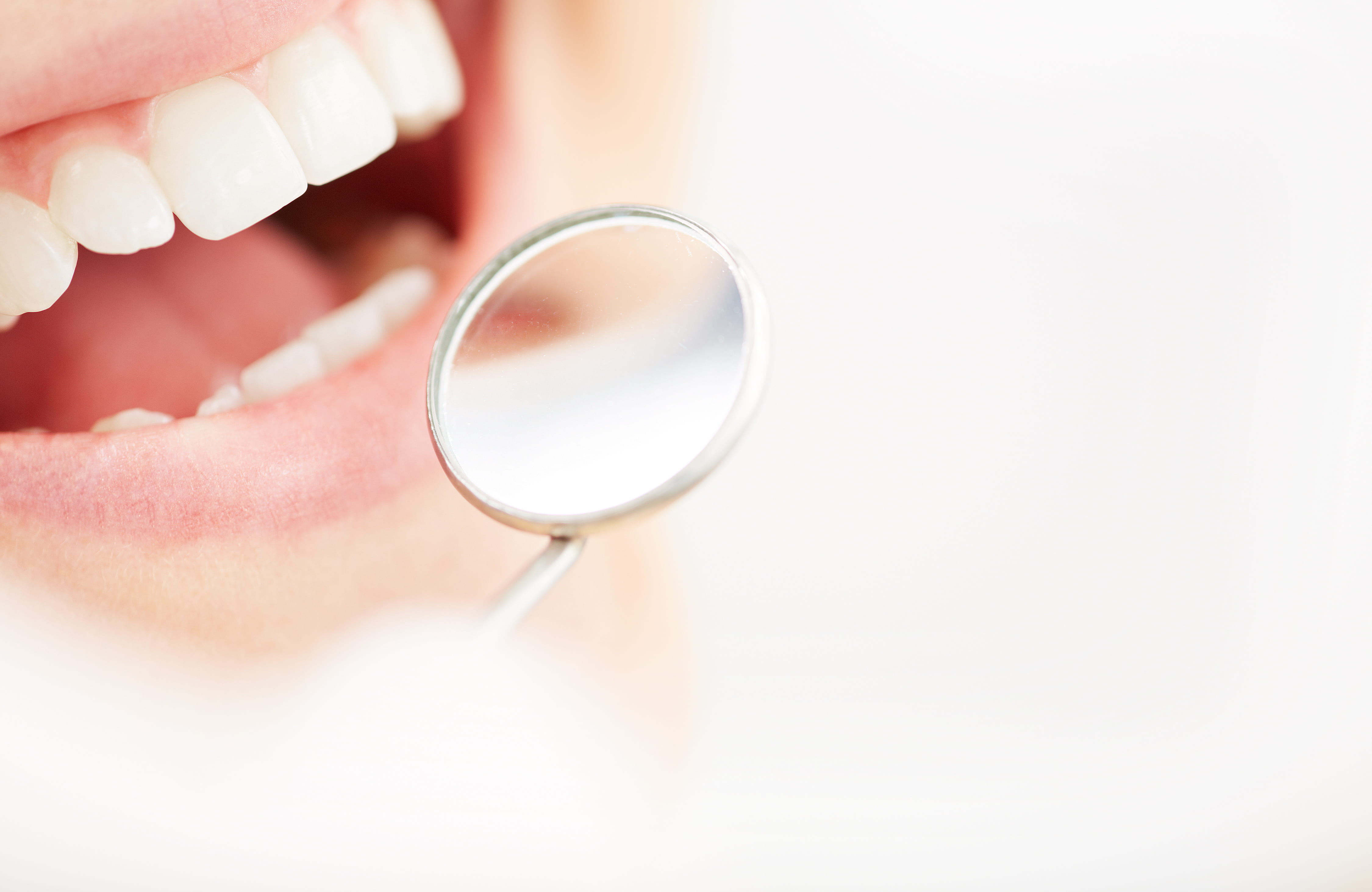 歯の定期検診が必要な理由とは？