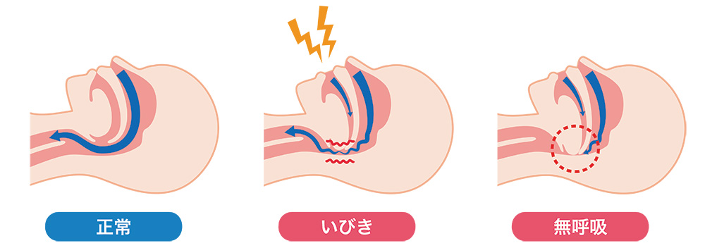 放置すると起こりうるリスク